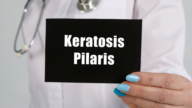 Doctor holding a sign with the words "keratosis pilaris"