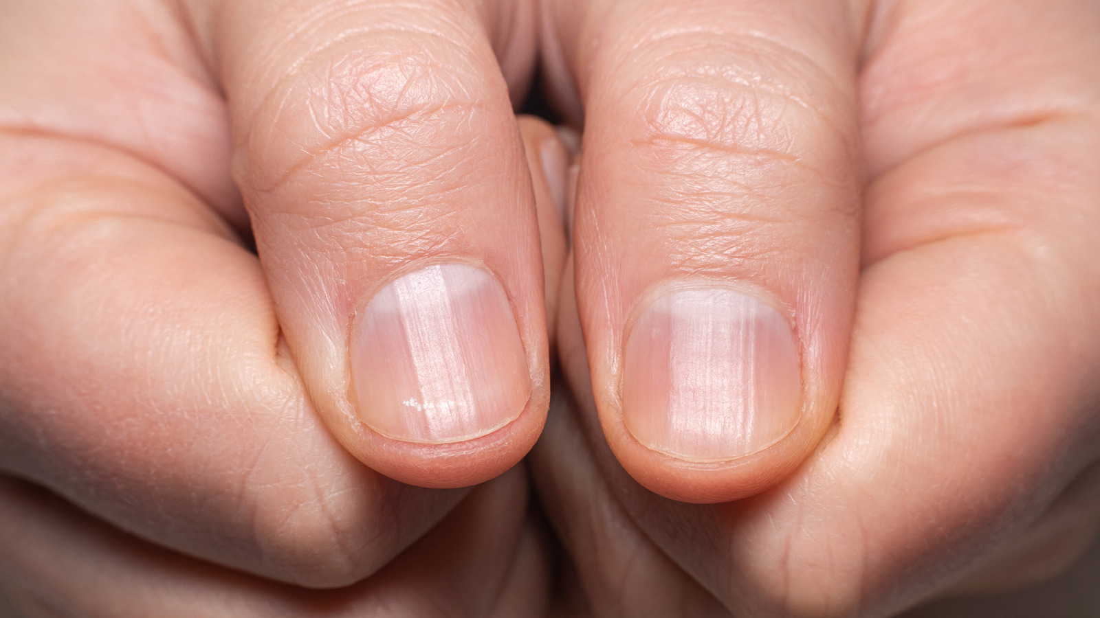 What's Causing That Black Line on Your Nail