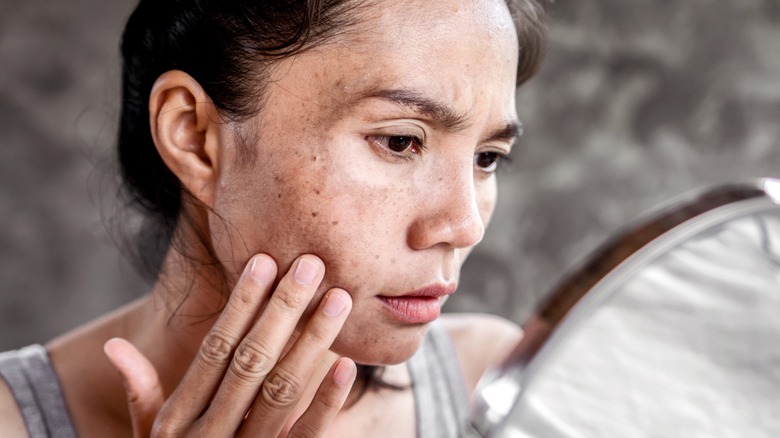 Woman looking at hyperpigmentation on face in mirror