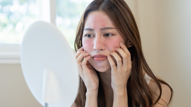 Woman with rosacea