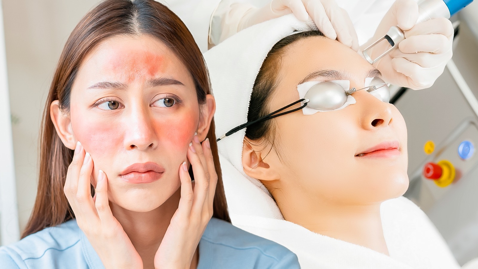Vbe In Cosmetics A Dermatologist Tells Us What To Expect Going Into A Vbeam Treatment ...