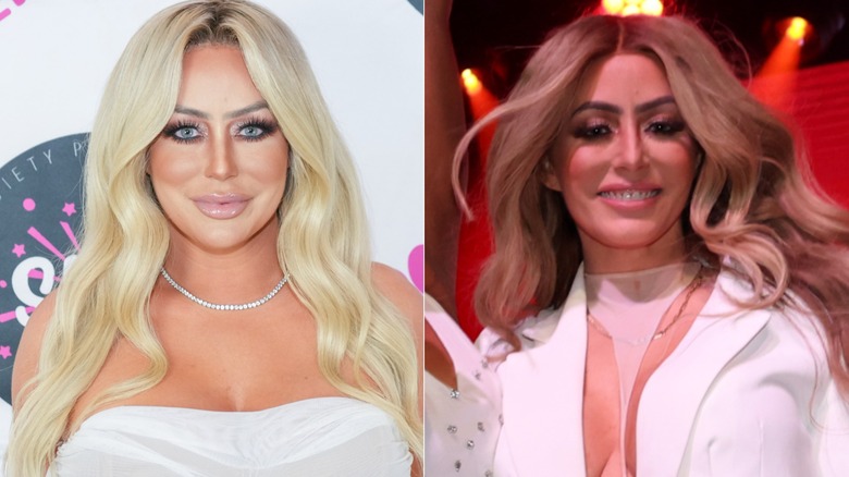 Aubrey O'Day with lip filler in 2023 and a more natural look in 2025