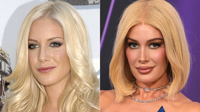 Heidi Montag looking more natural 2008 and with a tuned-up face in 2025