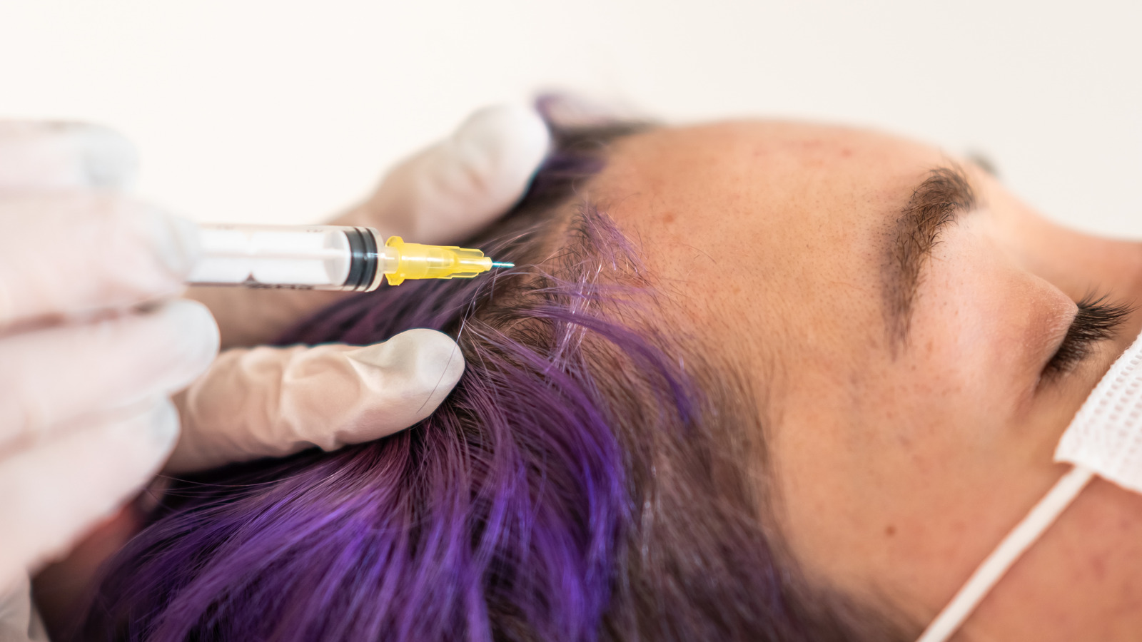 Can Botox On Your Hairline Keep The Sweat Away?