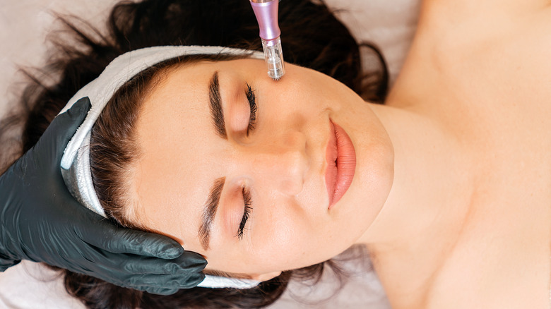 Woman getting microneedling procedure