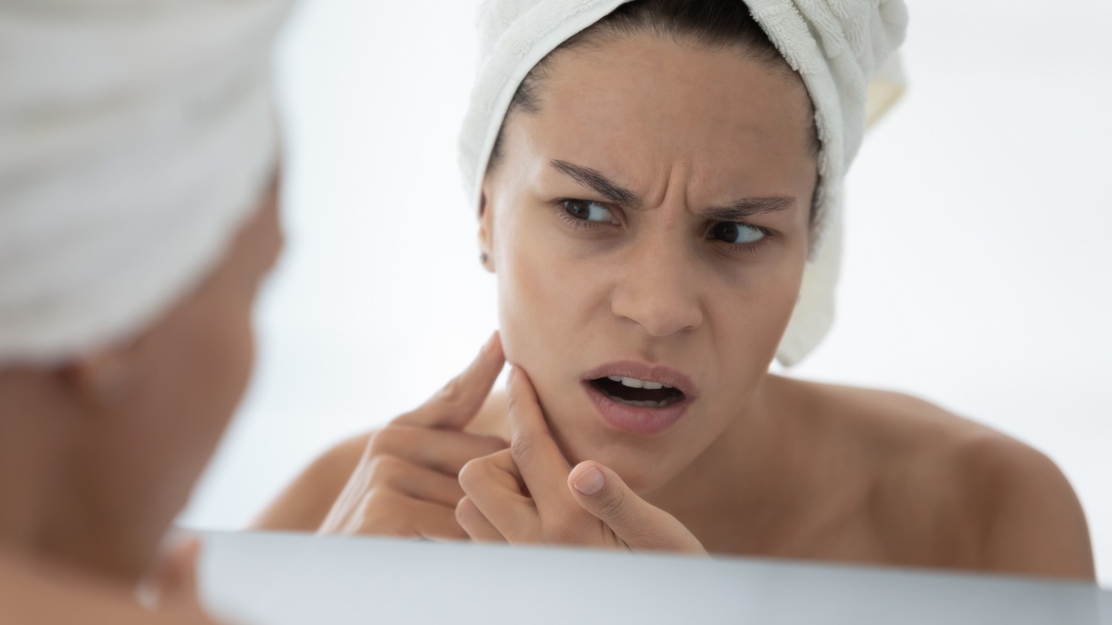 Can Taking Biotin Supplements Break Your Skin Out?