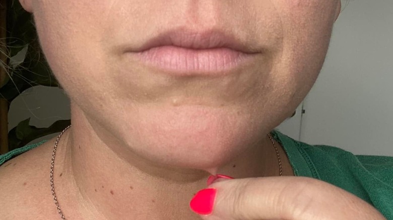 A Derm Explains Why Youre Getting Chin Hairs and What You Can Do About  Them  Glamour