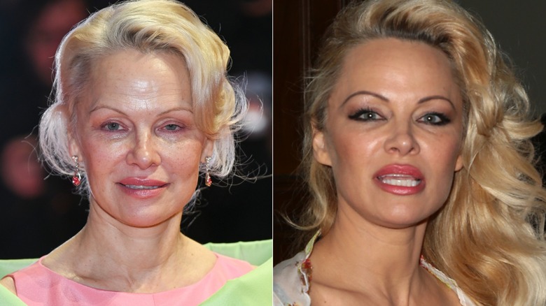 Side-by-side of Pamela Anderson with and without her eyebrows done. Left: Anderson with no makeup, her eyebrows are very thin and light in color. Right: Anderson has a full face of makeup. and her brows are very thin and drawn on with a dark brown eyebrow pencil.