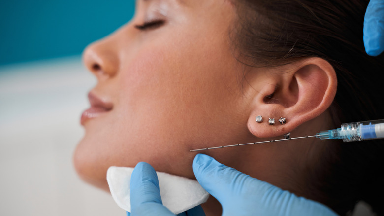 woman getting cheek filler