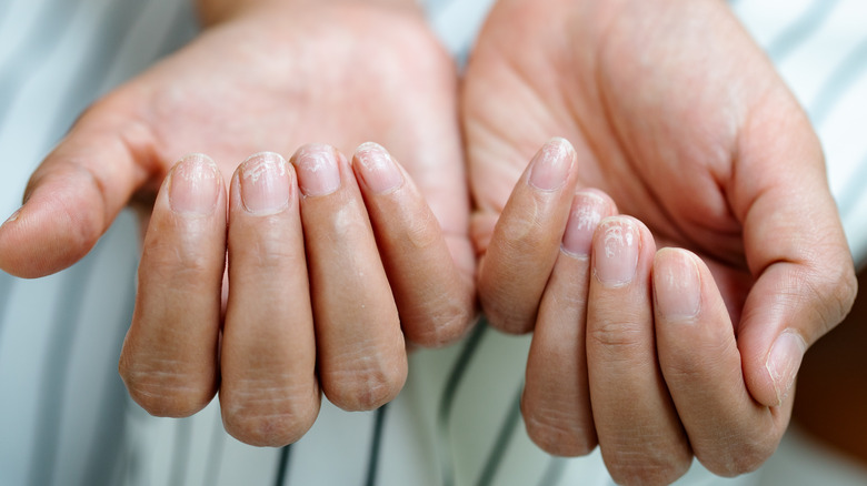 A hand flexing thin nails