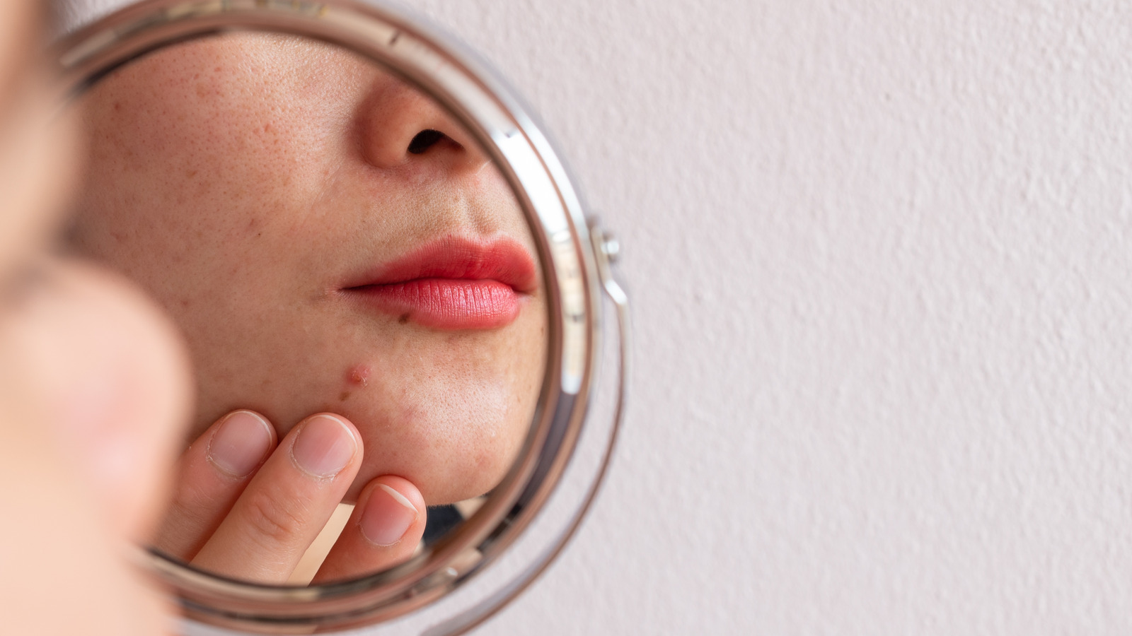 Does Kate Somerville EradiKate Acne Treatment Really Work?