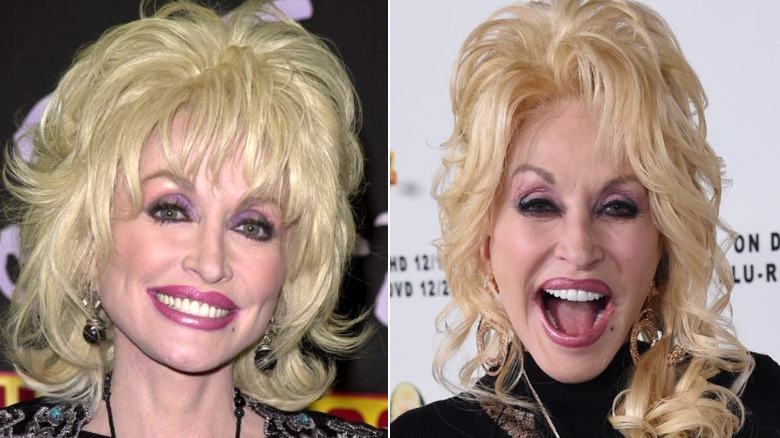 Dolly Parton with huge blond hair at appearances in 2001 and 2018