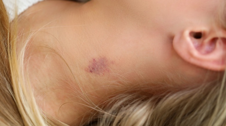 Blond girl with neck hickey