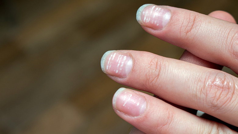 white spots on long nails