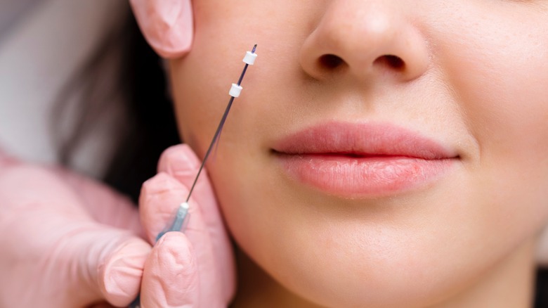 Practitioner holding needle for thread lift next to patient