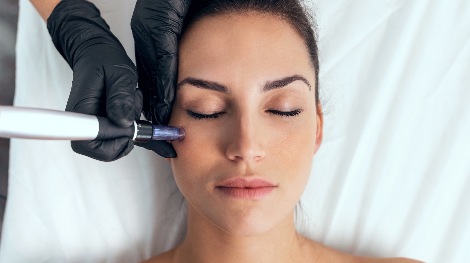 Get a Chiseled Face With Facial Liposuction