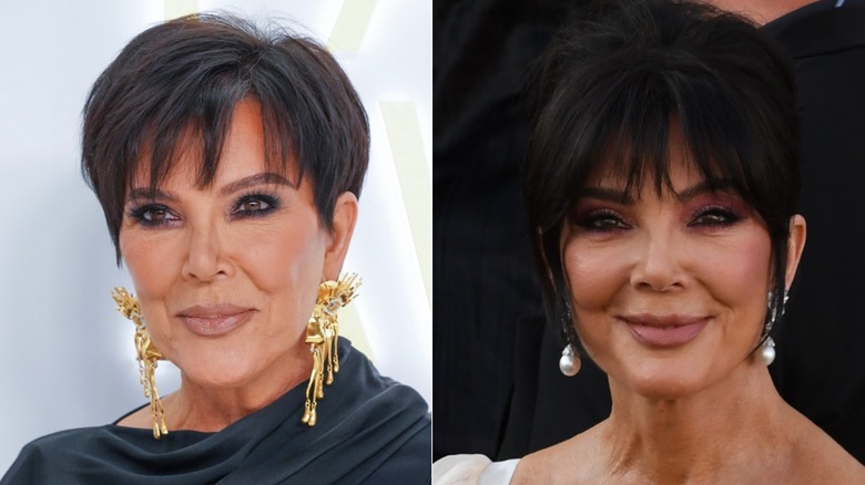 Kris Jenner before vs after 2025 face lift surgery