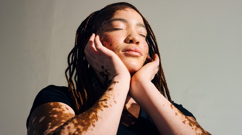 A woman holds her face in her hands.