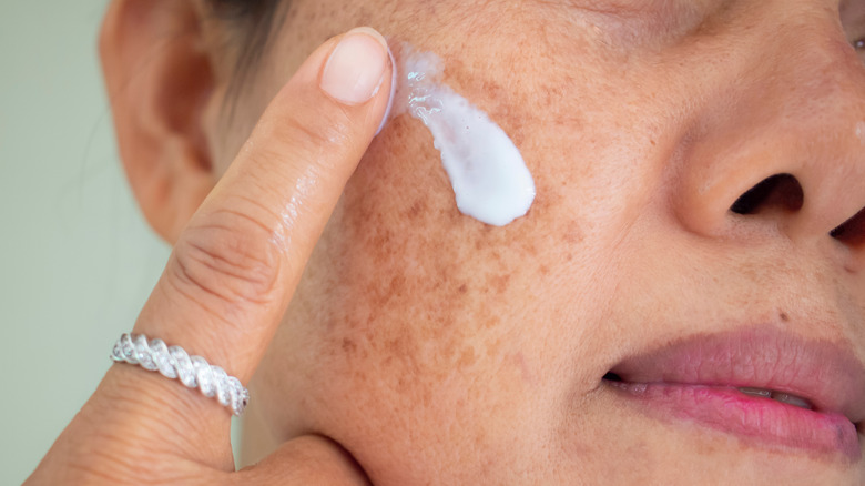 female with melasma applying treatment 