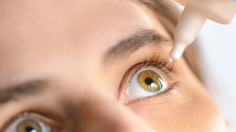 Woman putting eyedrops in eyes