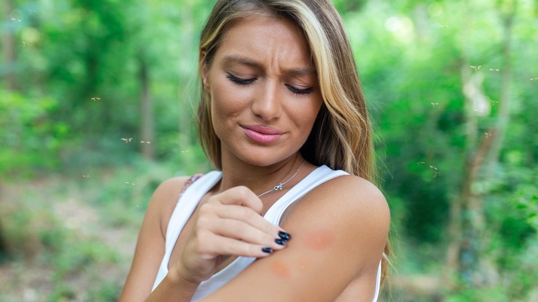 Woman with a rash