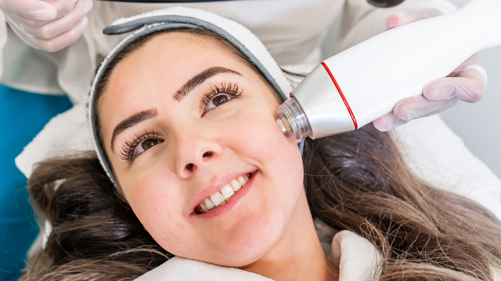Inside Radiofrequency Microneedling's Potential Side Effects