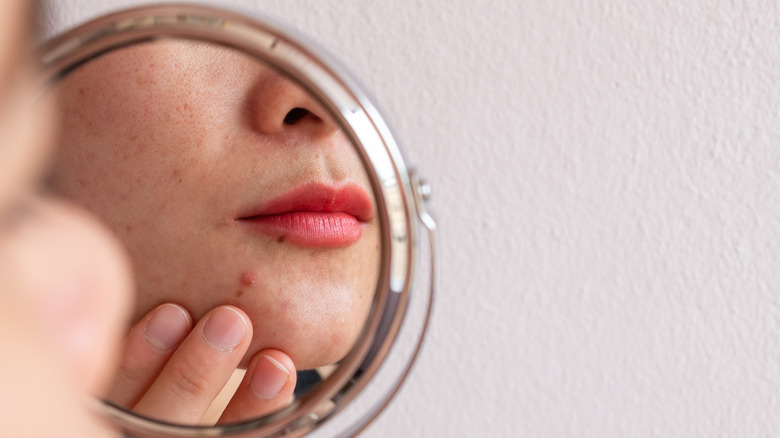cropped picture of woman looking in a mirror at her acne