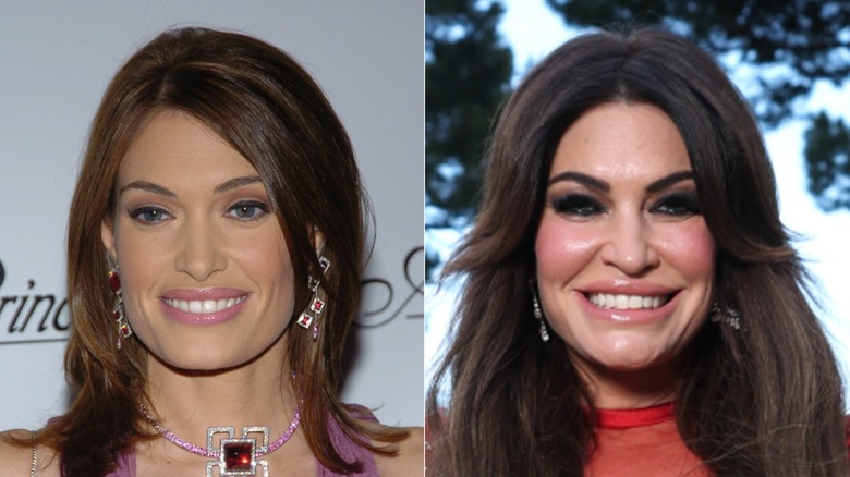 Kimberly Guilfoyle before and after her MAGA face transformation
