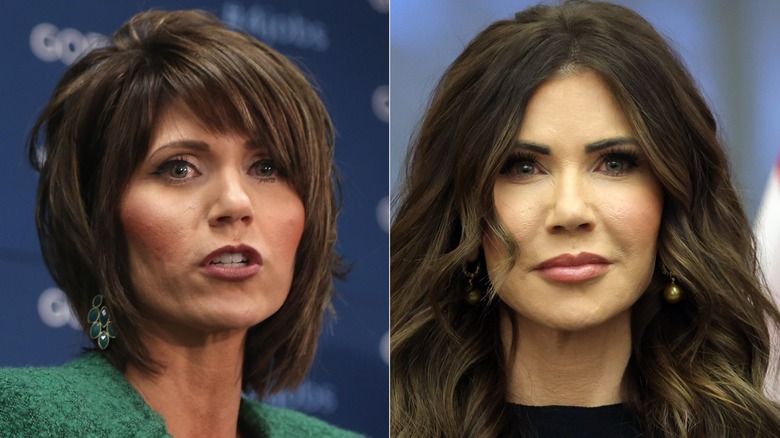Kristi Noem before and after her MAGA face transformation