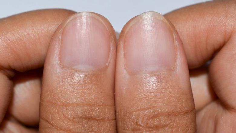 No Half Moons On Your Nails Here s What That May Mean