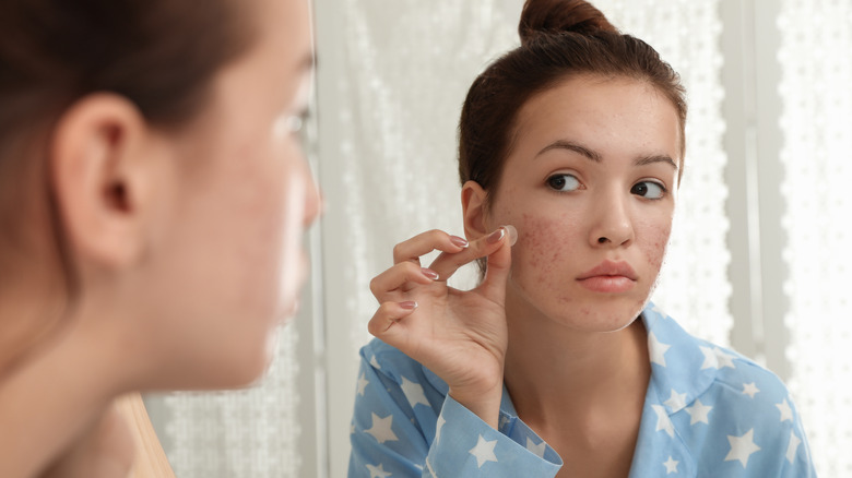young woman applying pimple patch