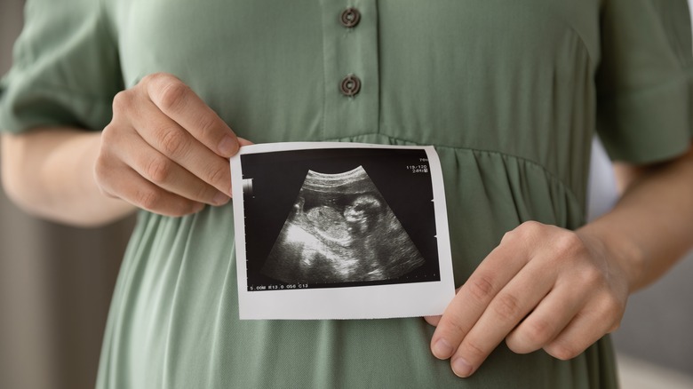 pregnant woman showing an ultra sound