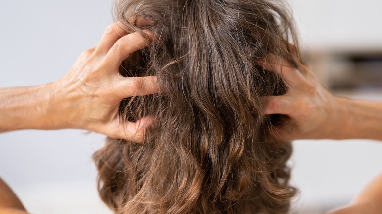 woman hair dandruff