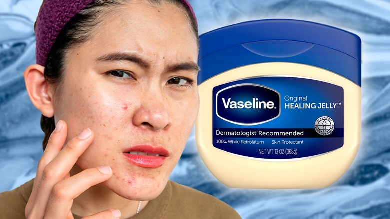 Woman with Vaseline