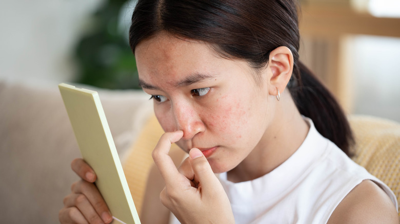 woman looking at acne in mirror