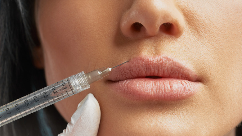 Lip filler close up