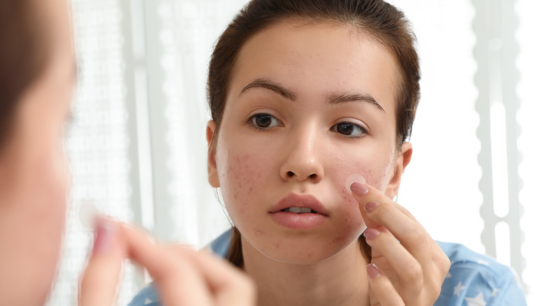 woman applying pimple patch