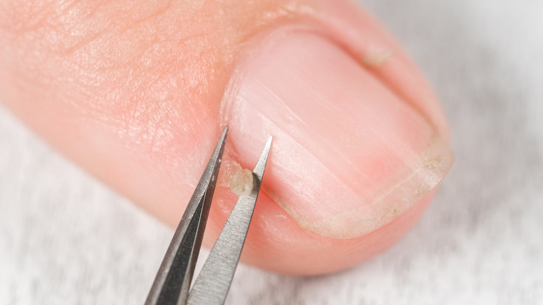 Scissors cutting a hangnail