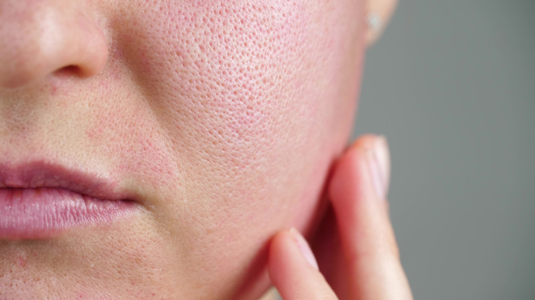 closeup imagine of a woman's face with open pores