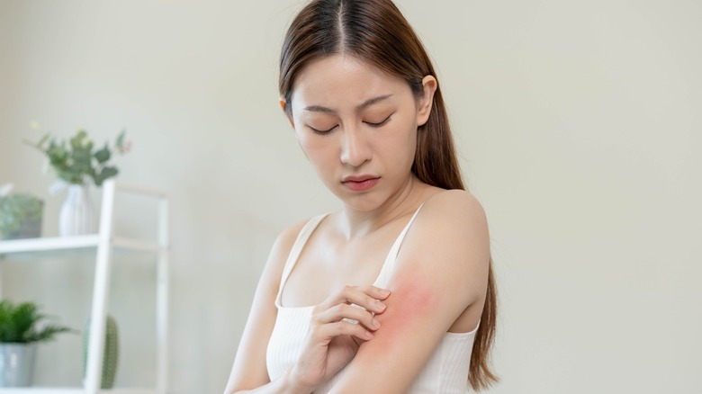 Woman inspecting eczema on her arm