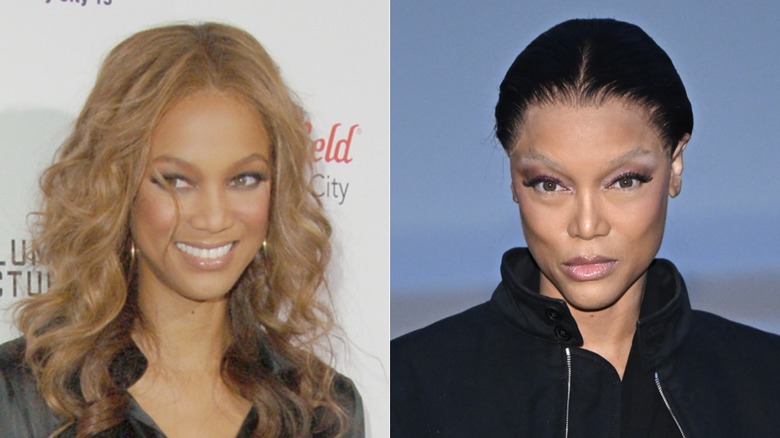 Tyra Banks's before and after her face changes