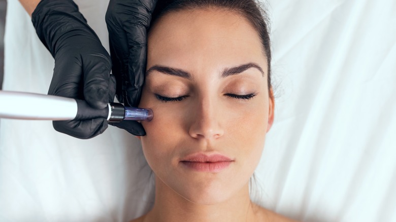 woman getting microneedling done