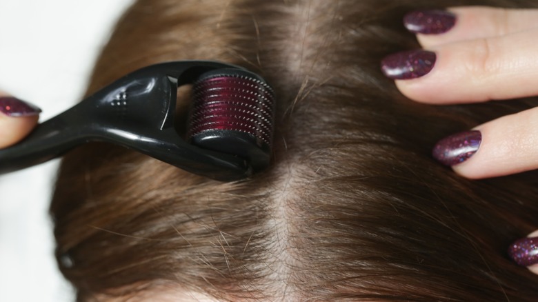 microneedling device used on scalp