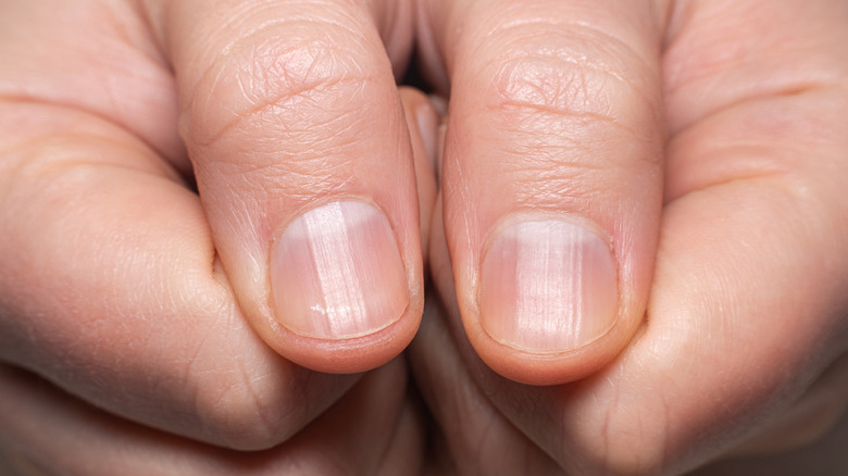 What Those Ridges On Your Fingernails Really Mean What Those Ridges On Your Fingernails Really Mean