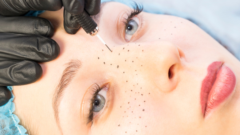 person getting freckle tattoos