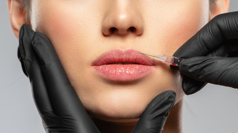 Close up of woman receiving syringe of lip filler