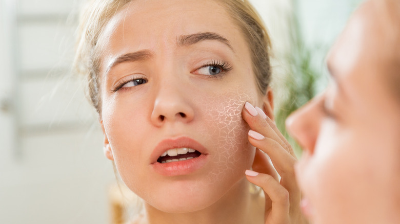 dry, scaly skin on woman's face