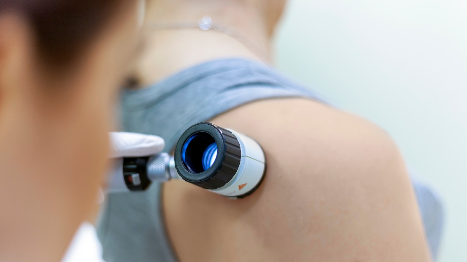 What To Expect When You Go For A Skin Cancer Check According To Our what-to-expect-when-you-go-for-a-skin-cancer-check-according-to-our