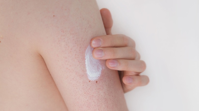 Hand rubbing cream onto keratosis pilaris on arm