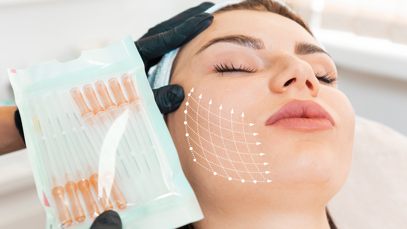 What You Need To Know Before Getting A Thread Lift